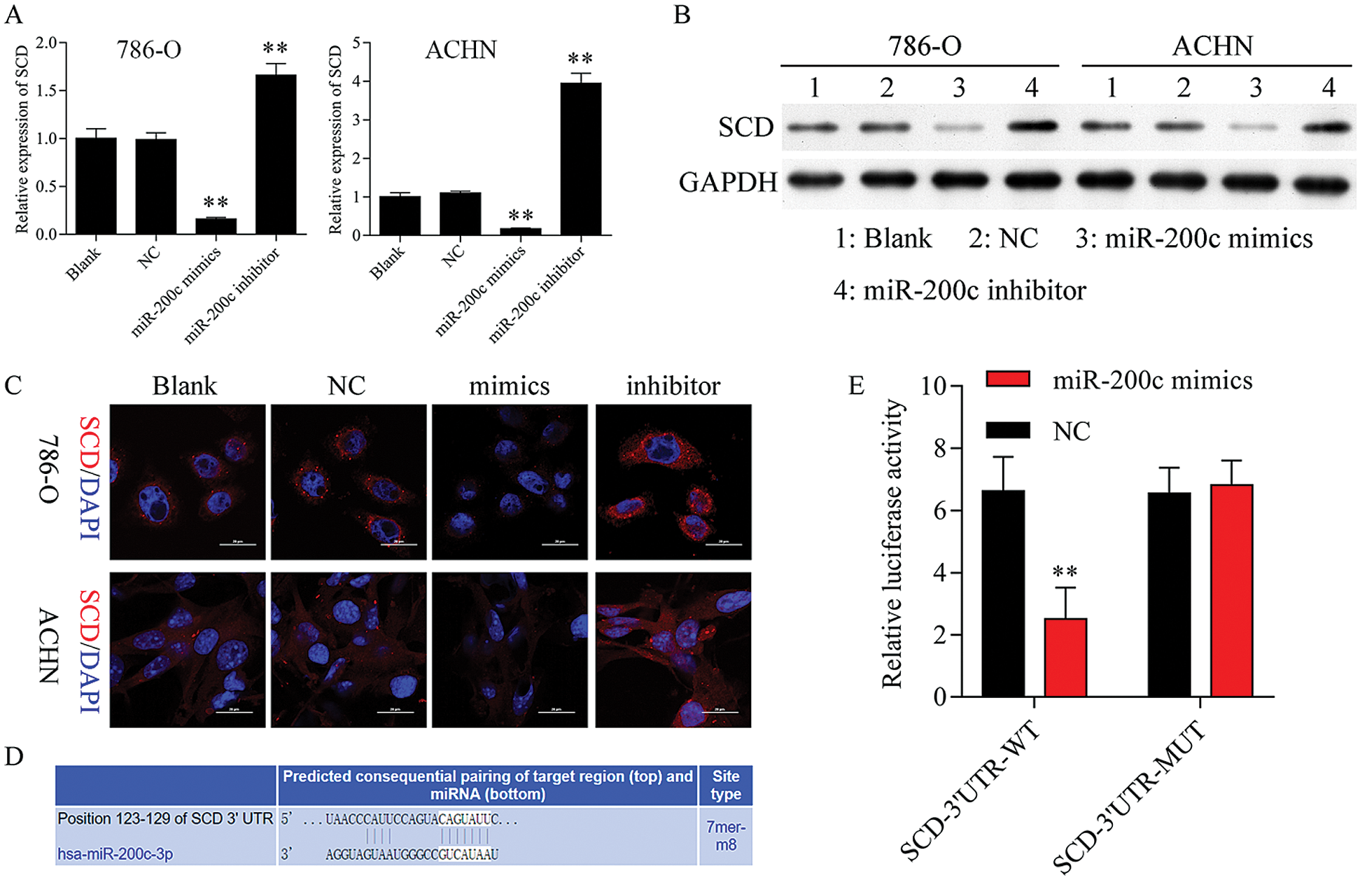 Tet Methylcytosine Dioxygenase Suppresses Renal Cell Cancer