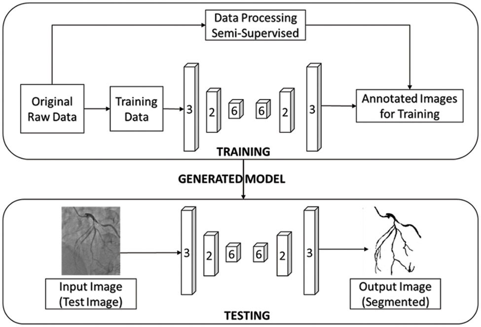 CMES | Free Full-Text | Vessels Segmentation in Angiograms Using ...