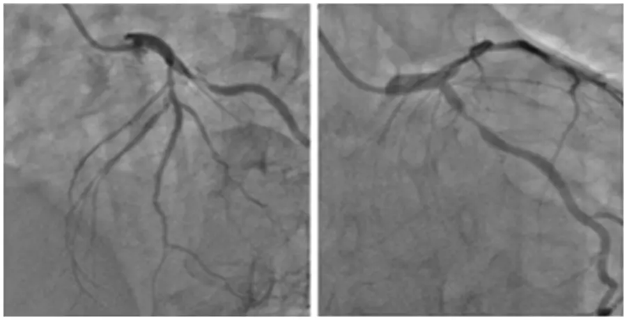 CMES | Free Full-Text | Vessels Segmentation in Angiograms Using ...