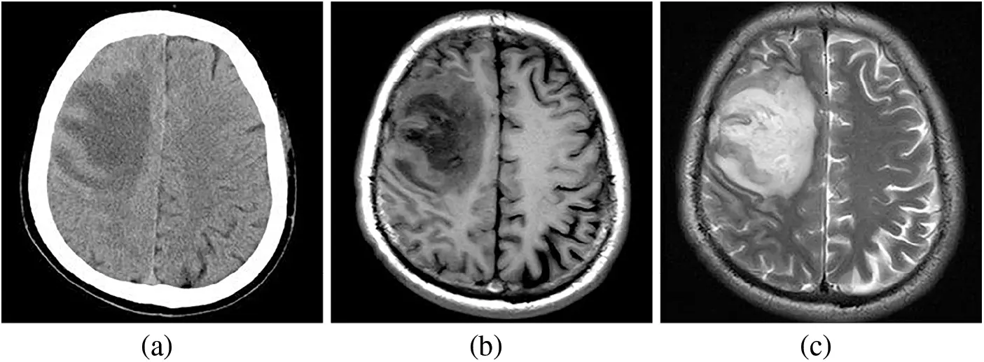 Contrast Normalization CMES | Free Full-Text | Contrast Normalization Strategies in Brain ...