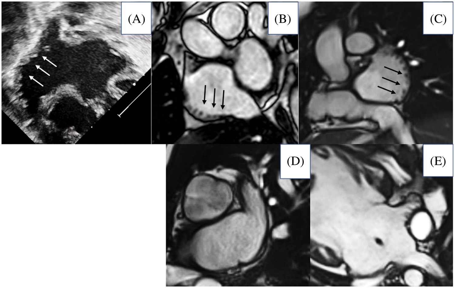 CHD Free FullText Classifying Cardiac Anomalies in Right and Left