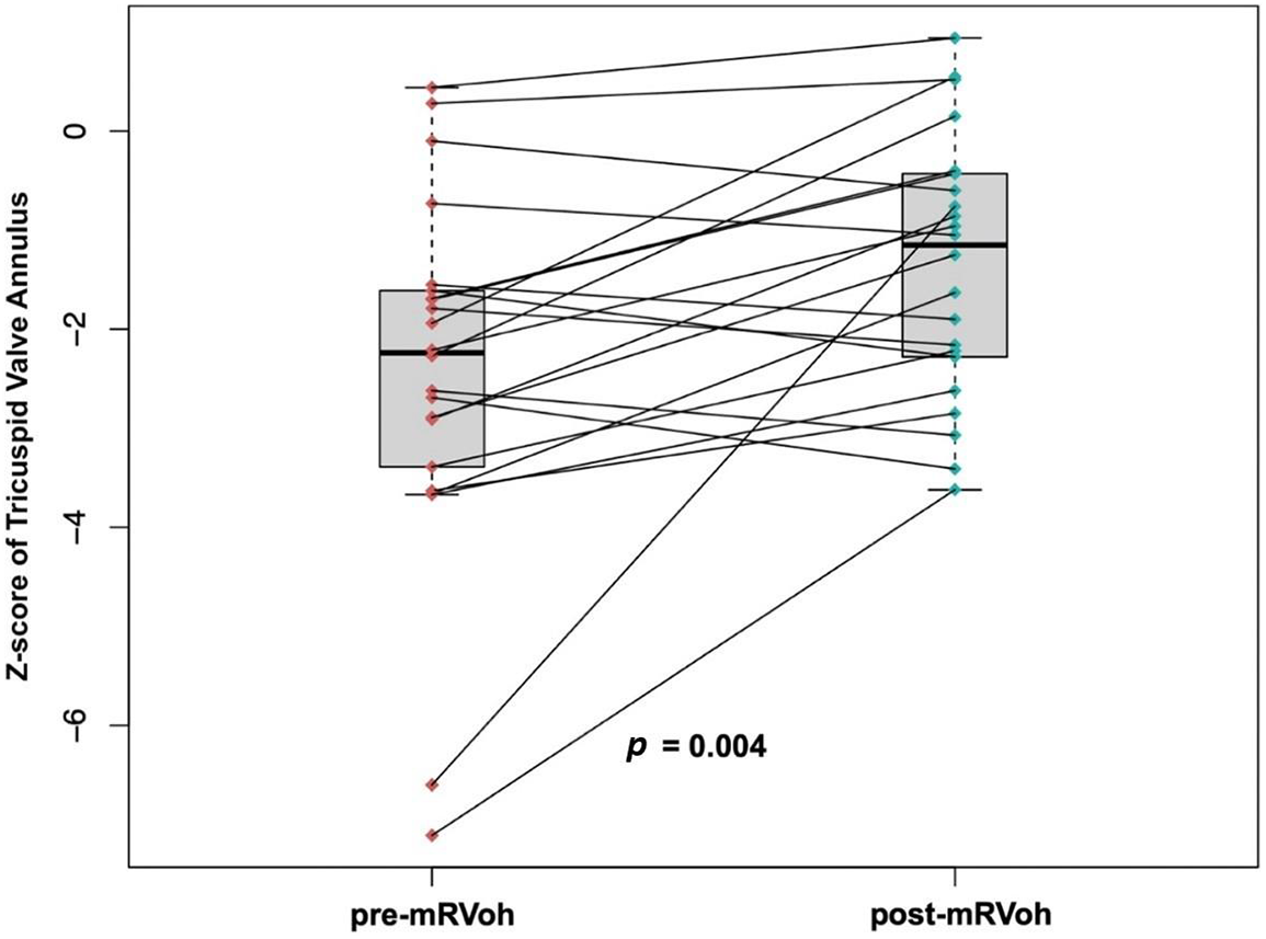 CHD Free FullText Role of Surgery on Growth of Tricuspid Valve in