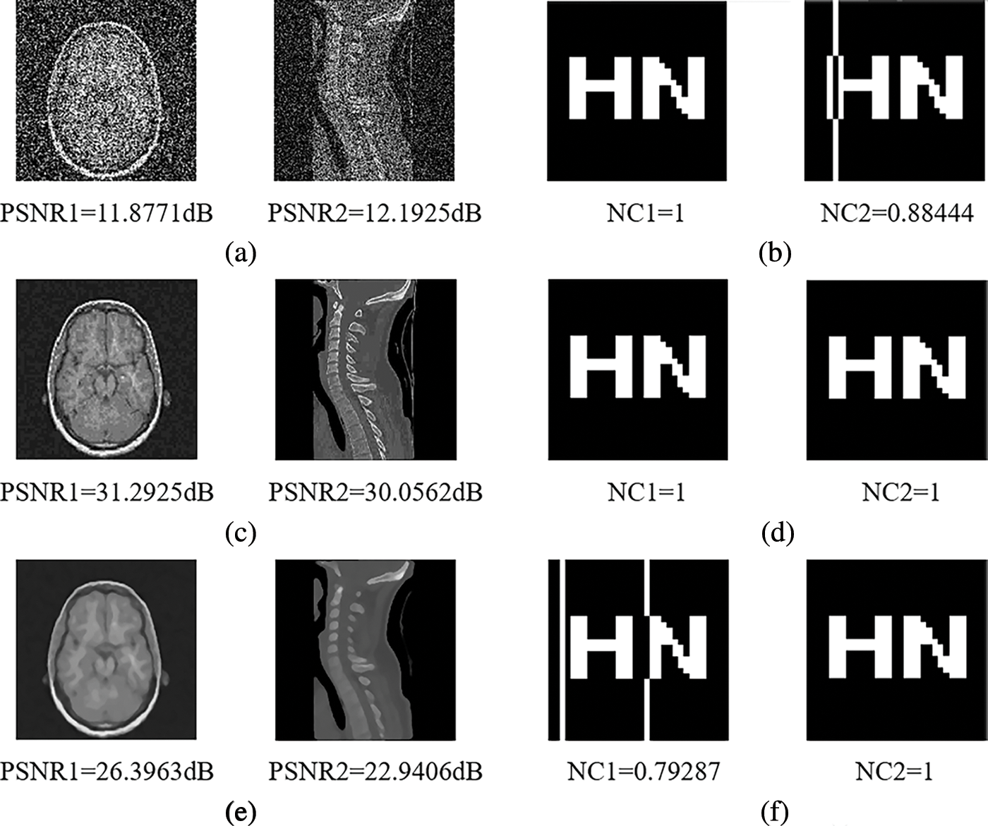 CMC | Free Full-Text | Robust Watermarking Algorithm For Medical Images ...