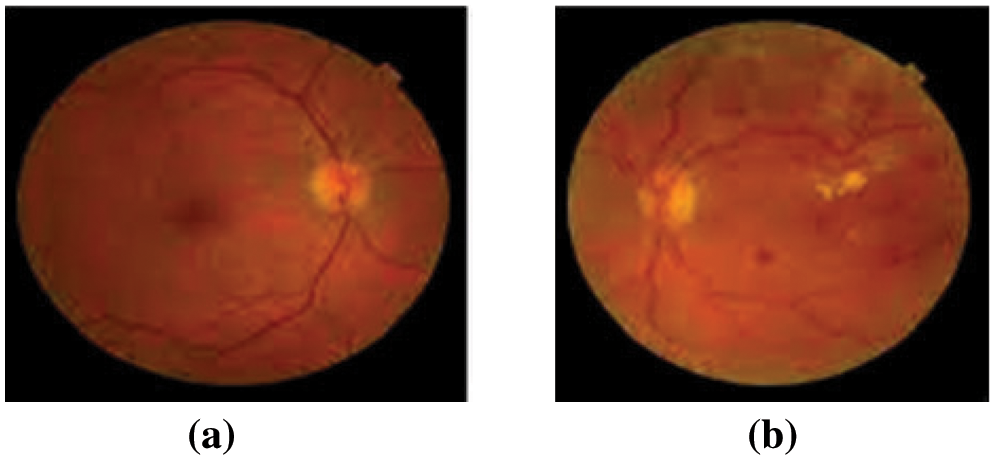 CMC | Free Full-Text | Strategy for Rapid Diabetic Retinopathy Exposure ...