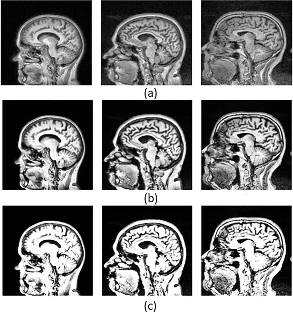 CMC | Free Full-Text | Alzheimer’s Disease Stage Classification Using a ...