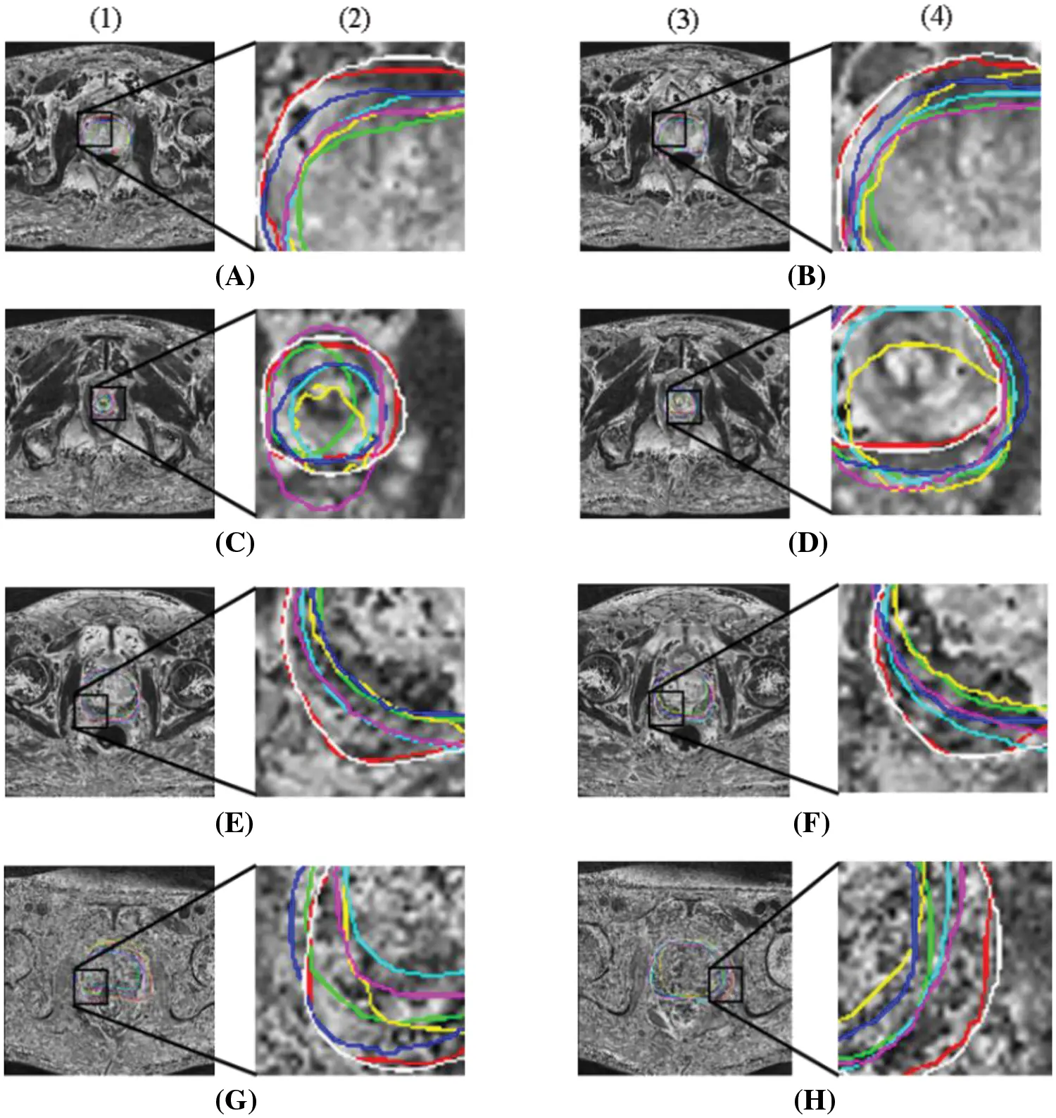 CMC | Free Full-Text | Attention Guided Multi Scale Feature Fusion ...