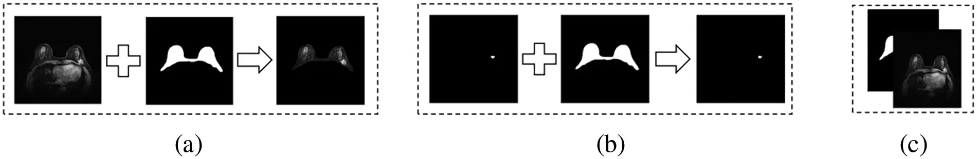 CMC | Free Full-Text | Two Stages Segmentation Algorithm of Breast ...