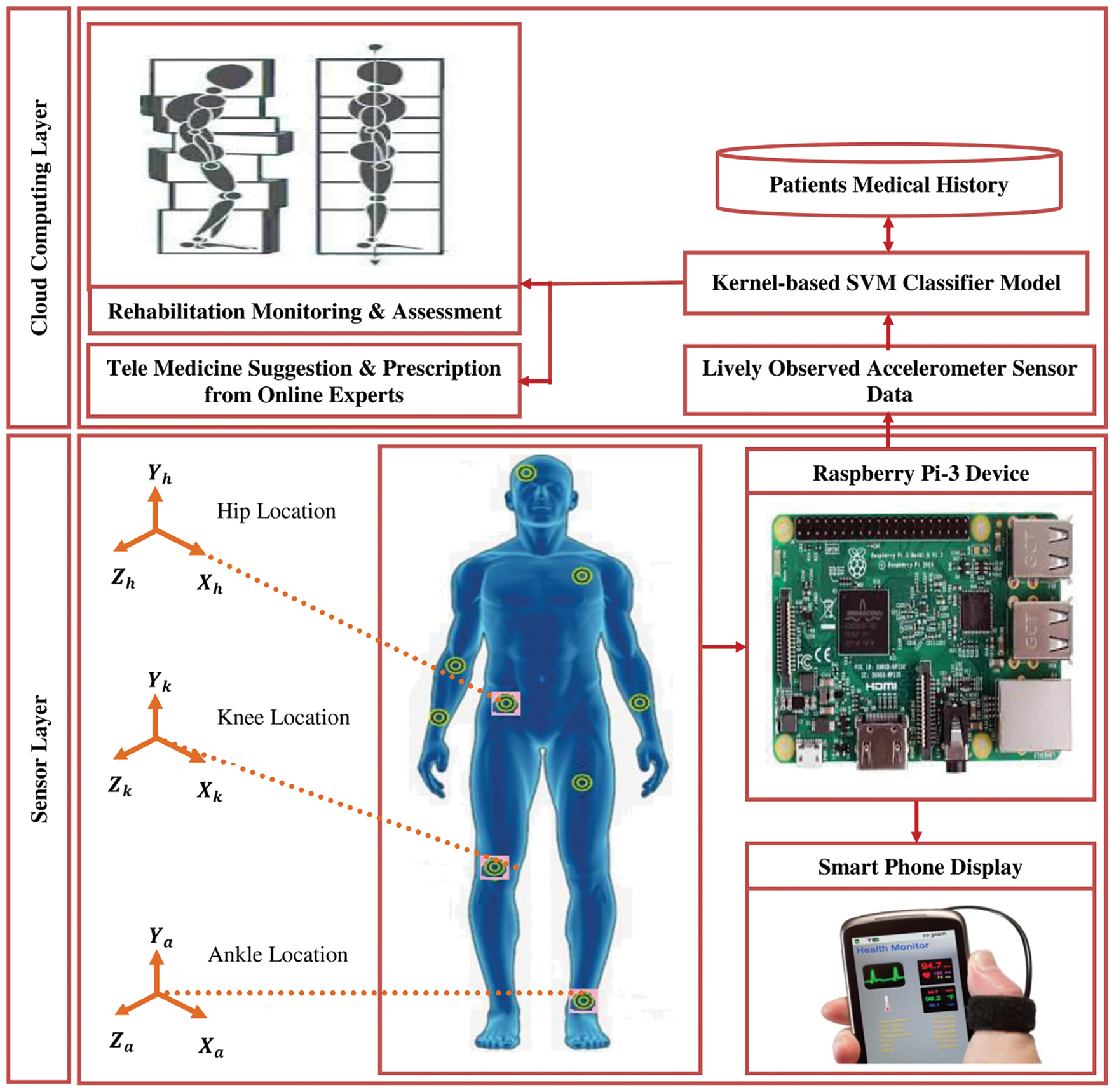 IASC | Free Full-Text | Sensor-Based Gait Analysis for Parkinson’s ...