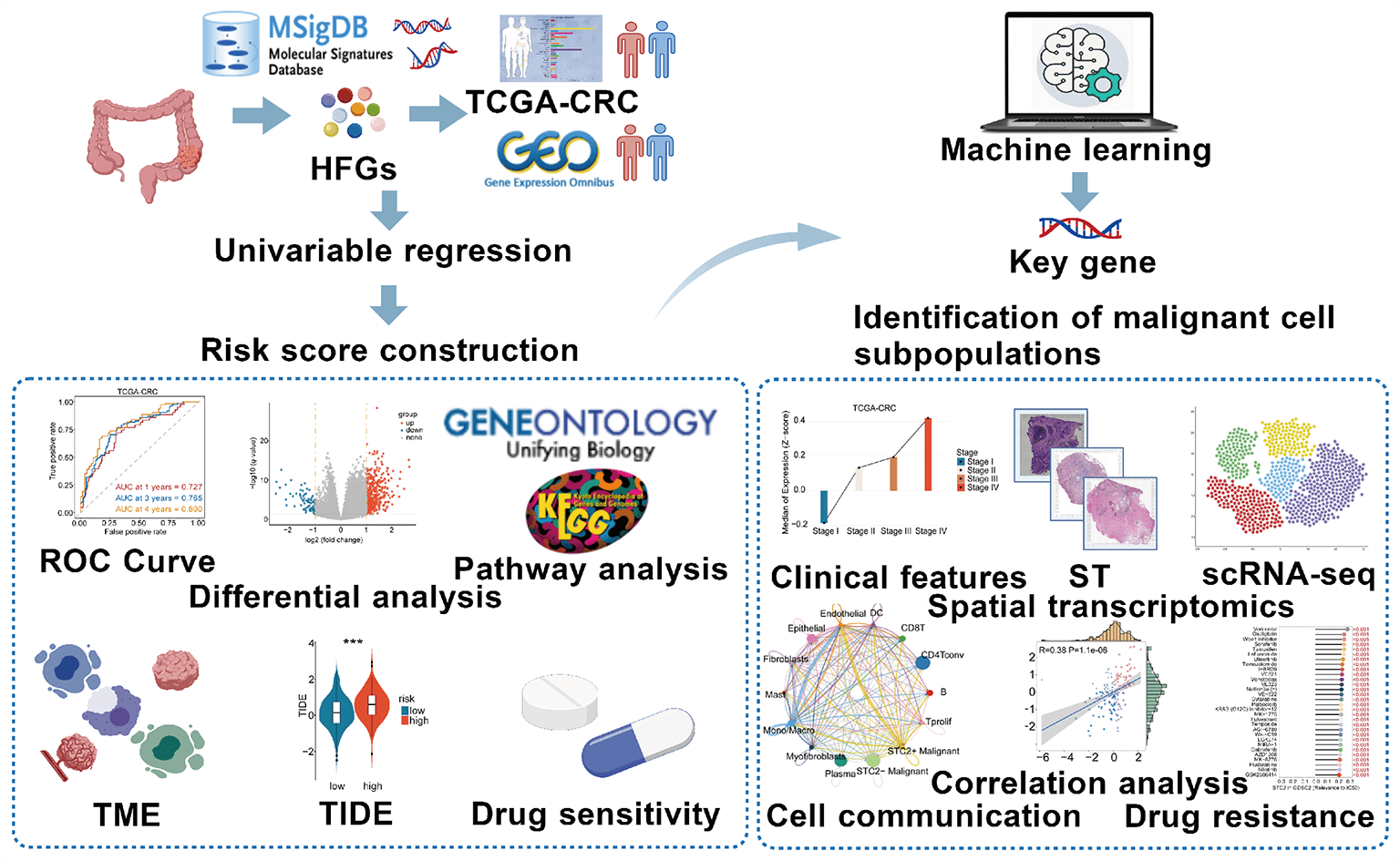STC2+ Malignant Cell State Associated with EMT, Tumor Microenvironment Remodeling, and Poor Prognosis Revealed by Single-Cell and Spatial Transcriptomics in Colorectal Cancer