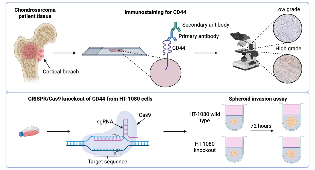 Exploring the Role of CD44 in the Progression and Invasion of Chondrosarcoma