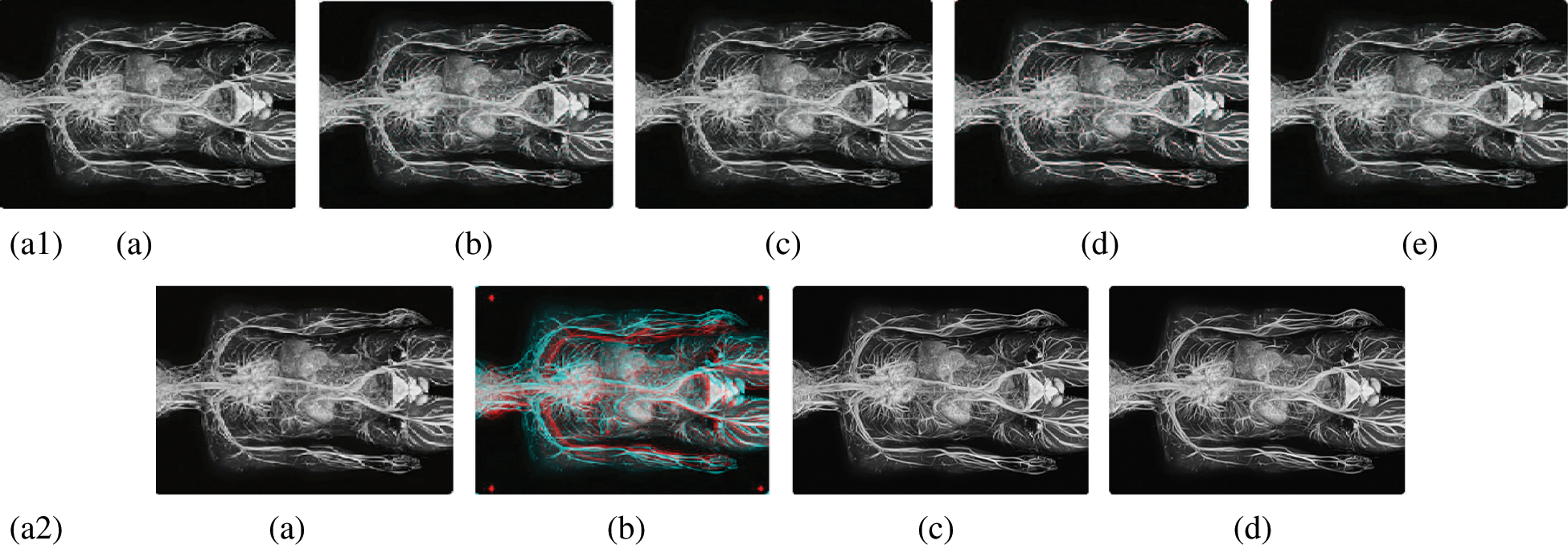 Medical Image Compression Based on Wavelets with Particle Swarm ...