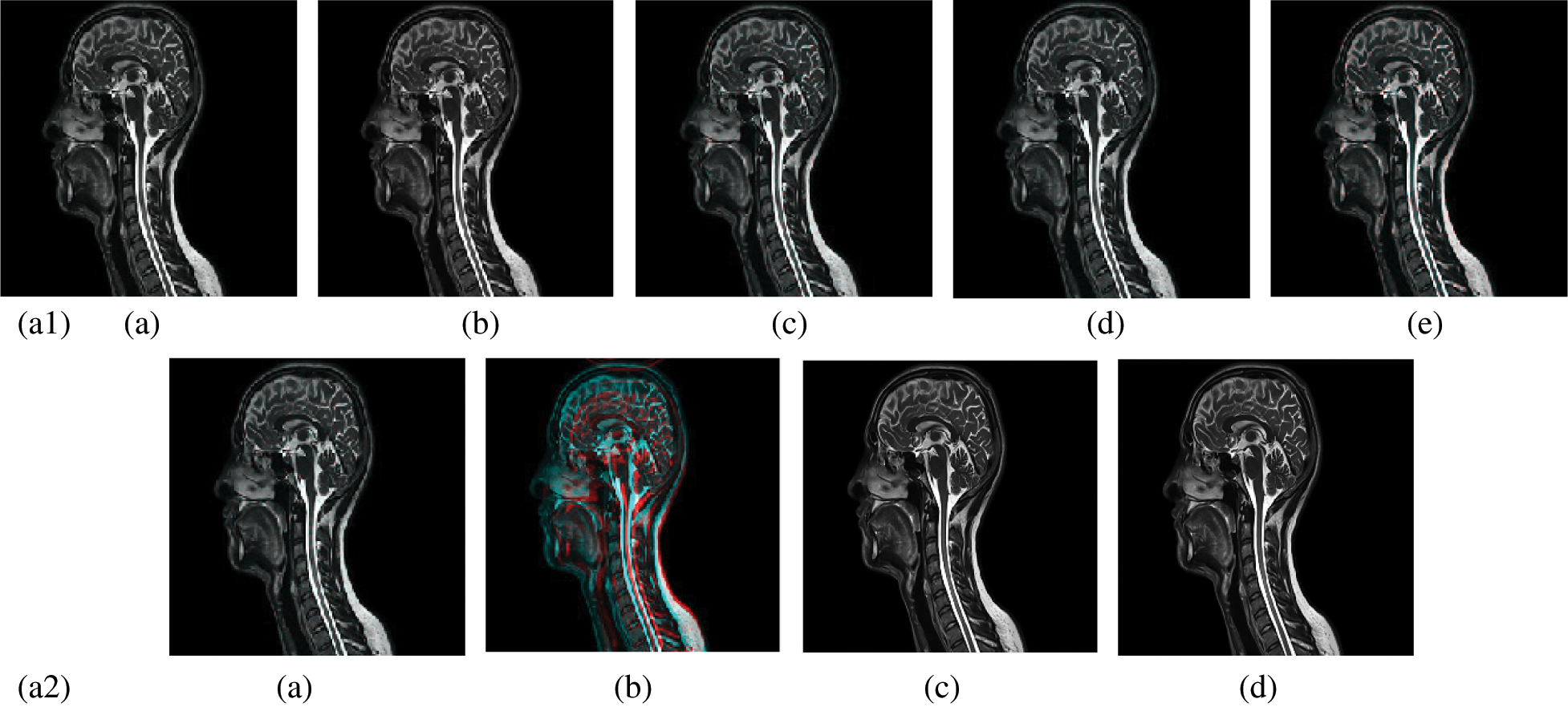 Medical Image Compression Based on Wavelets with Particle Swarm ...