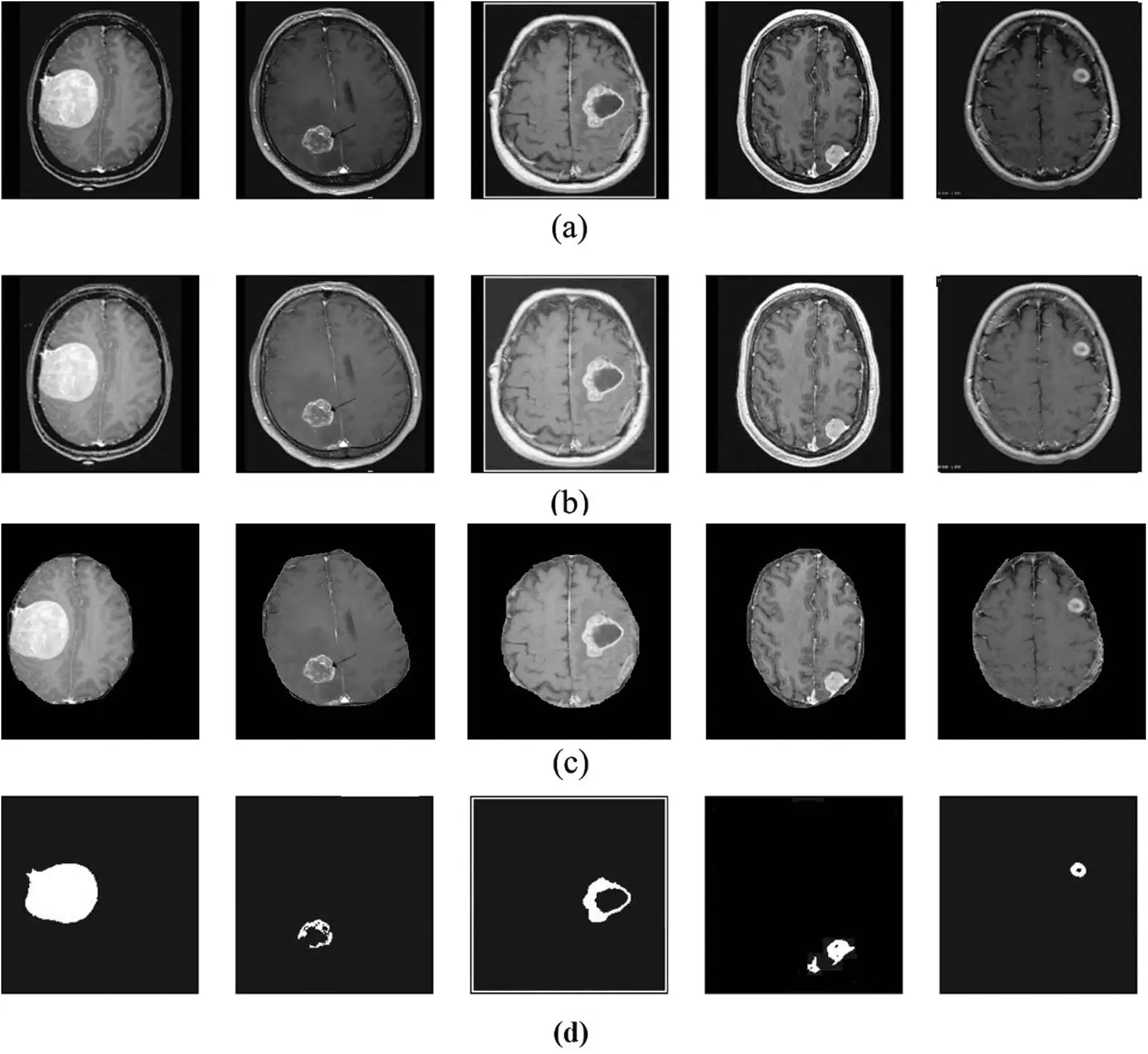 Segmentation of Brain Tumor Magnetic Resonance Images Using a Teaching ...