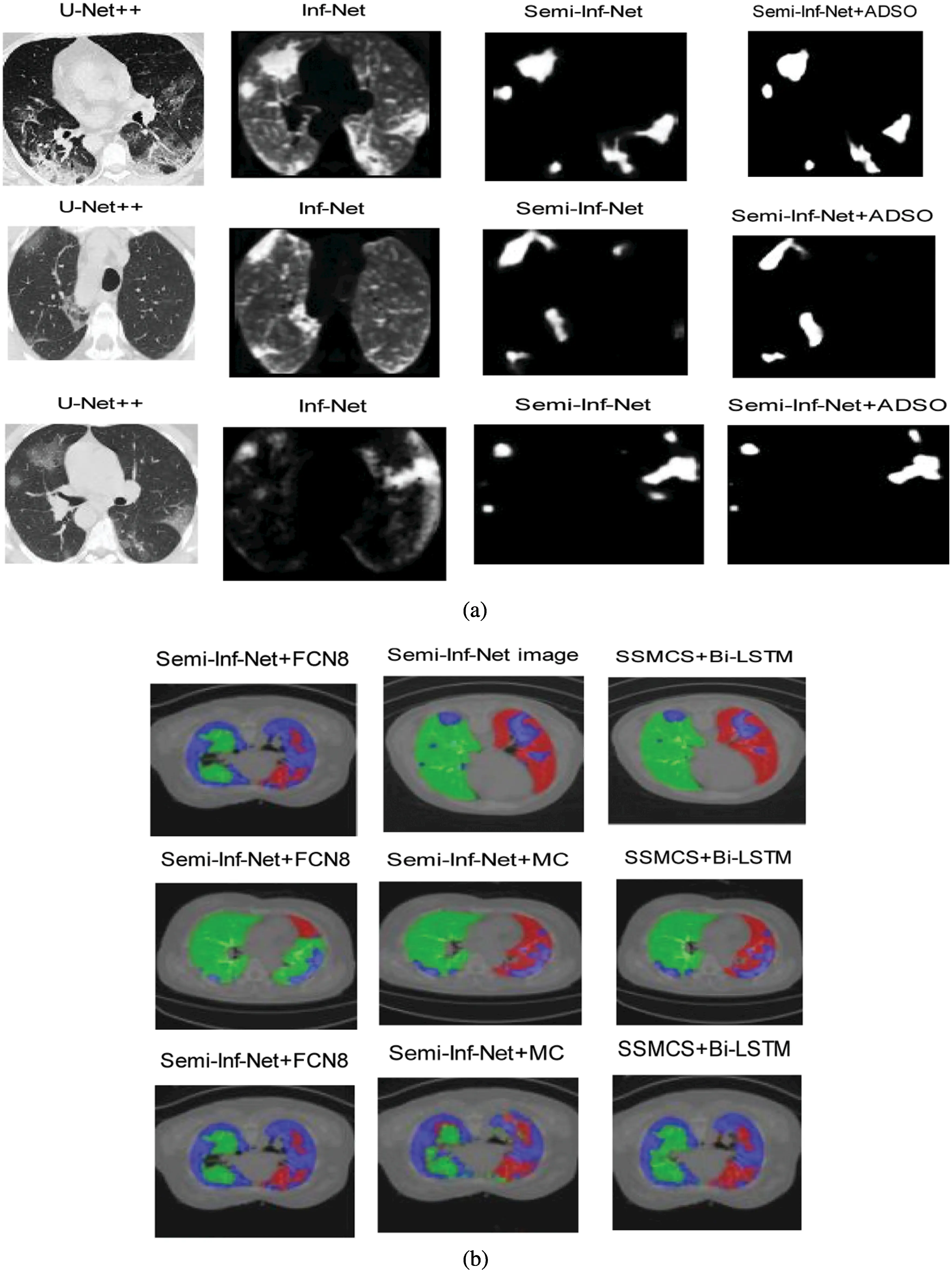 Covid-19 CT Lung Image Segmentation Using Adaptive Donkey and Smuggler ...