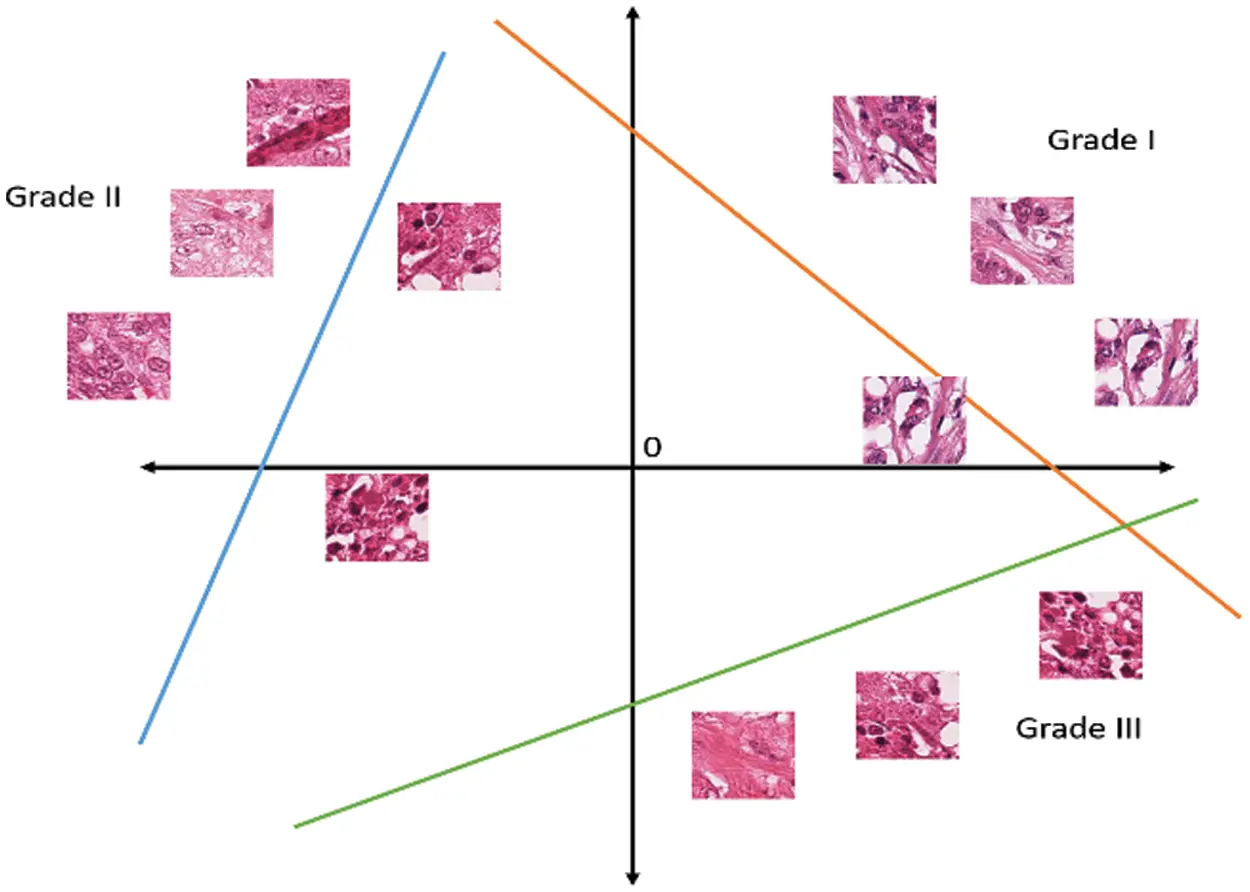 Automated Grading of Breast Cancer Histopathology Images Using ...