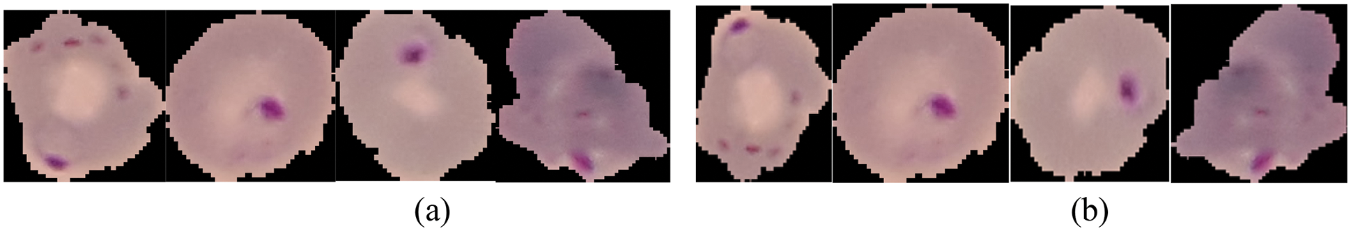 A Novel Convolutional Neural Network Model for Malaria Cell Images ...