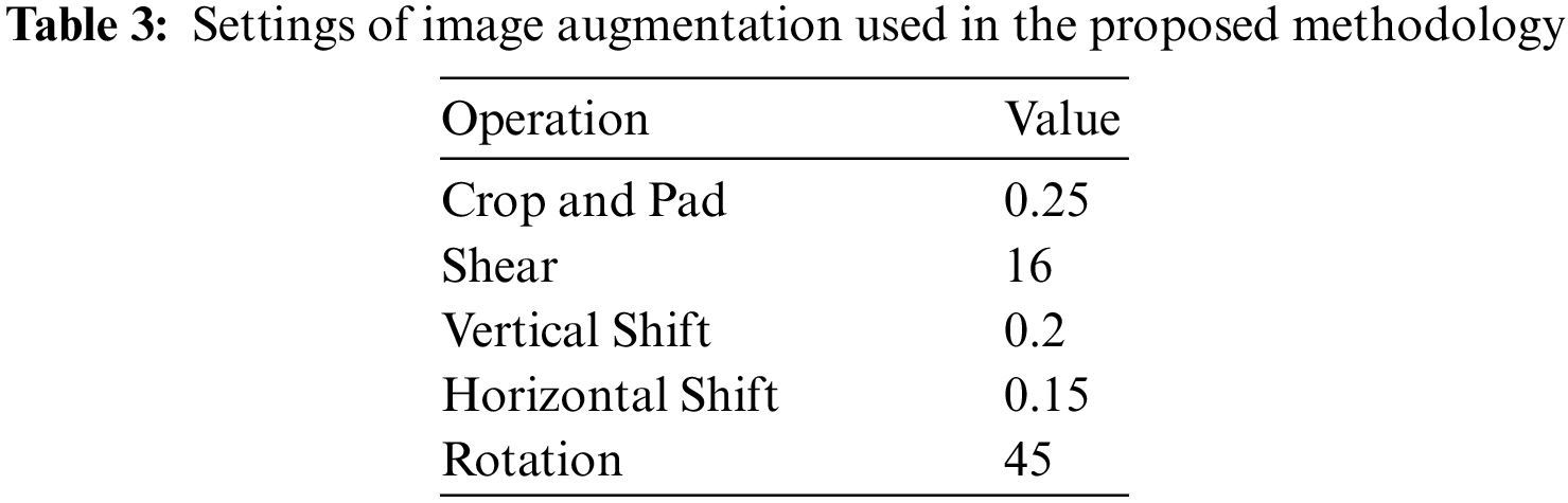 Transfer Learning for Chest X-rays Diagnosis Using Dipper Throated ...