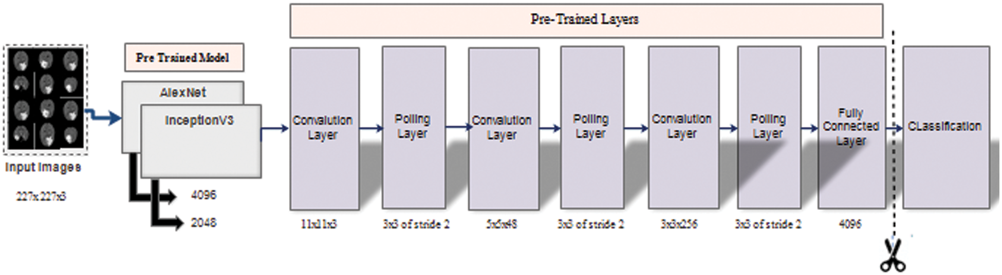 Brain Tumor Detection and Classification Using PSO and Convolutional ...