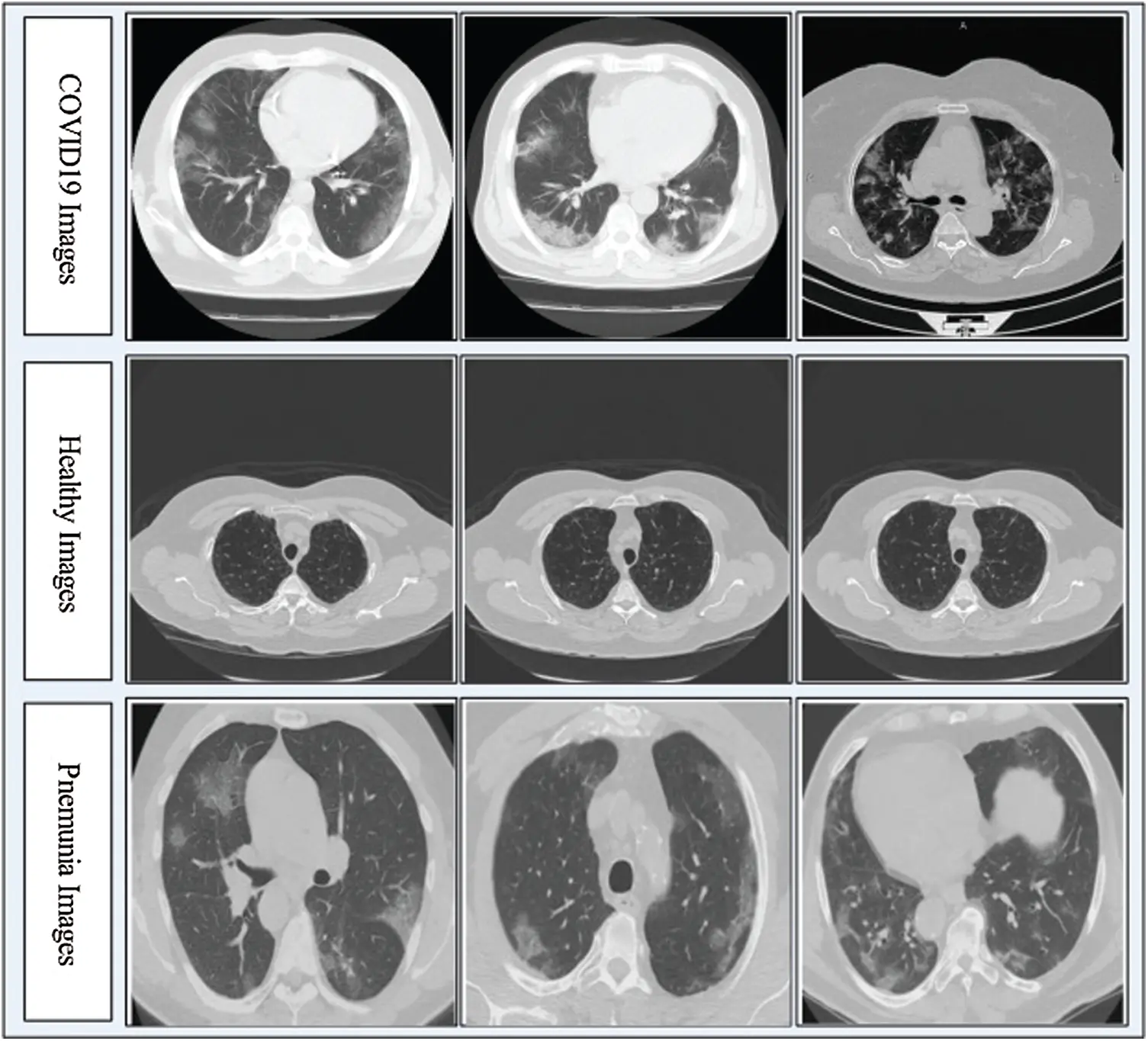 COVID19 Classification Using CT Images via Ensembles of Deep Learning ...