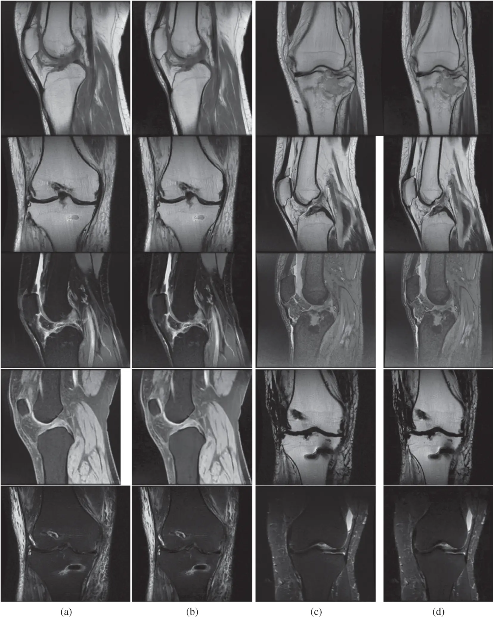 Denoising Medical Images Using Deep Learning in IoT Environment