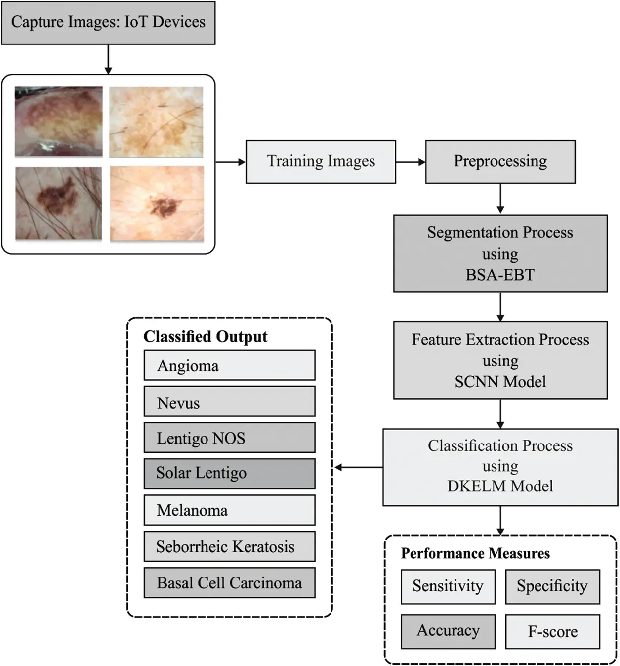Deep Learning with Backtracking Search Optimization Based Skin Lesion ...