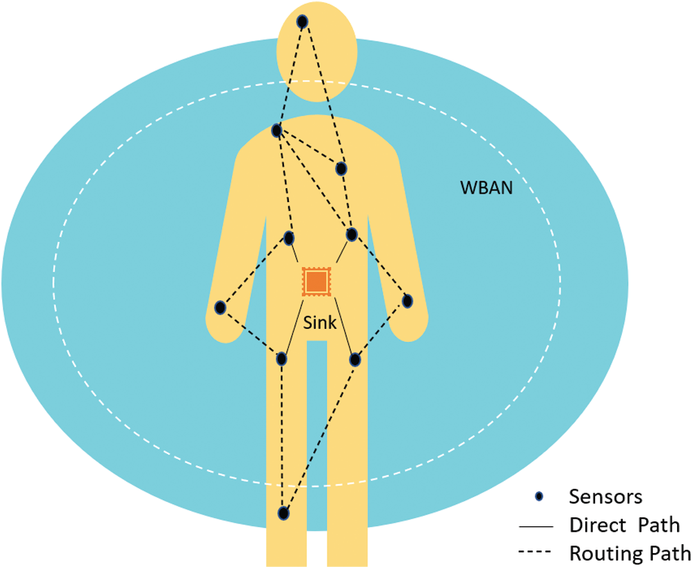 An Efficient Energy Aware Routing Mechanism for Wireless Body Area Networks