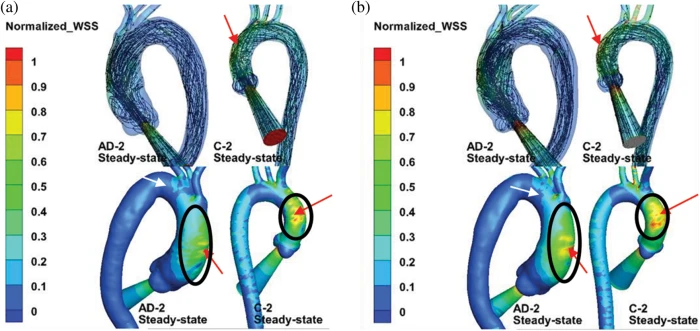 Ex vivo biaxial load testing analysis of aortic biomechanics demonstrates  variation in elastic energy distribution across the aortic zone zero -  ScienceDirect