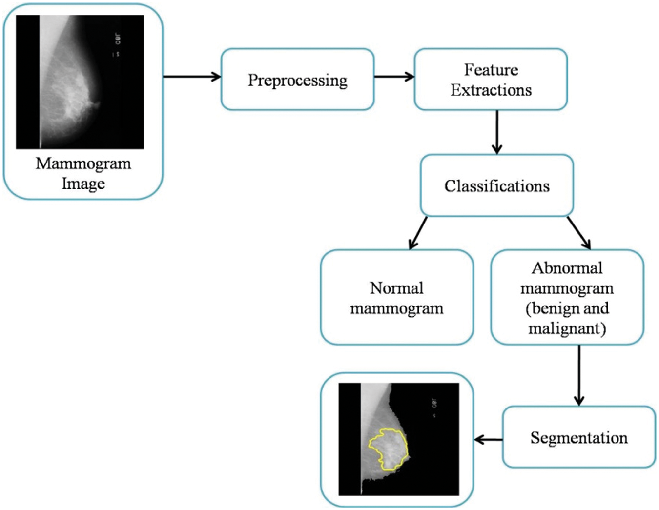 Performance Analysis of Breast Cancer Detection Method Using ANFIS ...
