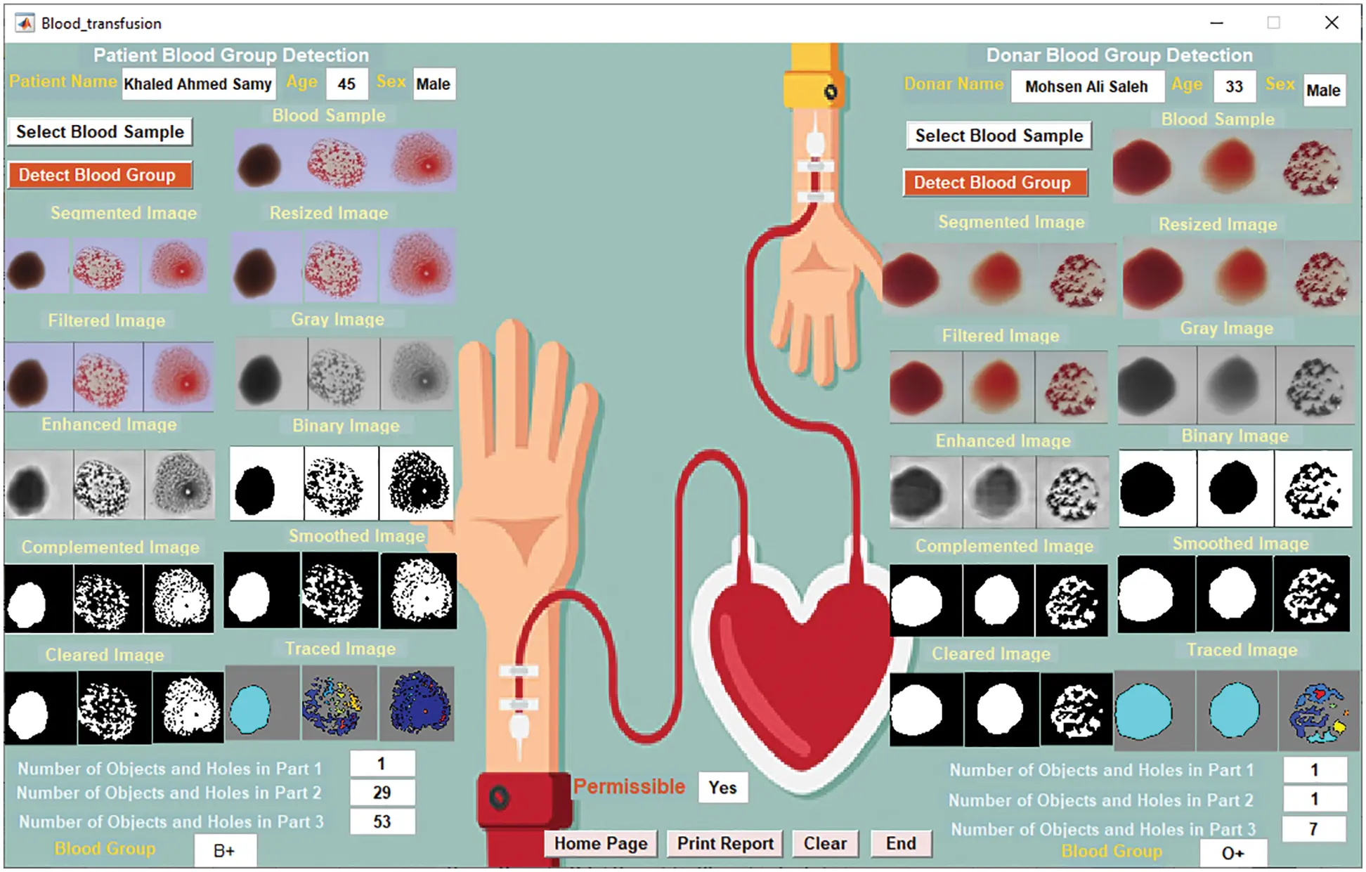 Blood Group Classification System Based on Image Processing Techniques