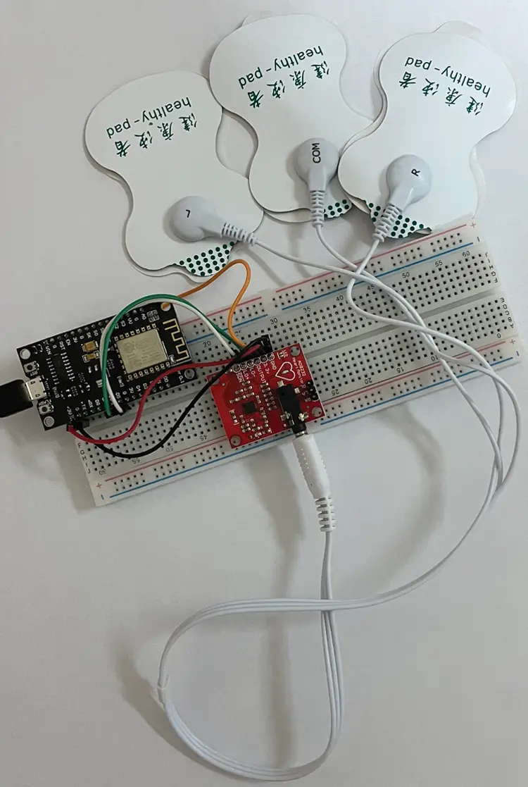 A Wireless ECG Monitoring and Analysis System Using the IoT Cloud