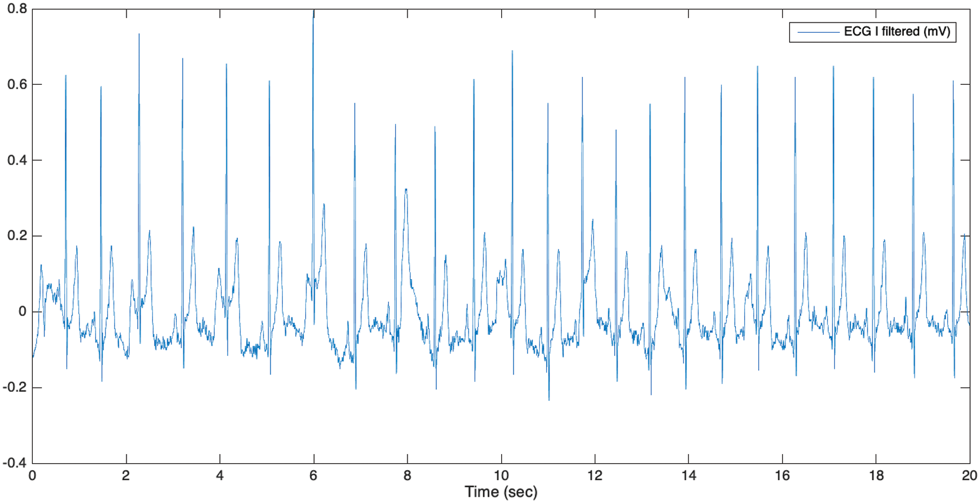 A Wireless ECG Monitoring and Analysis System Using the IoT Cloud