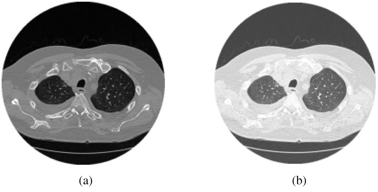 Lung Nodule Detection Based on YOLOv3 Deep Learning with Limited Datasets