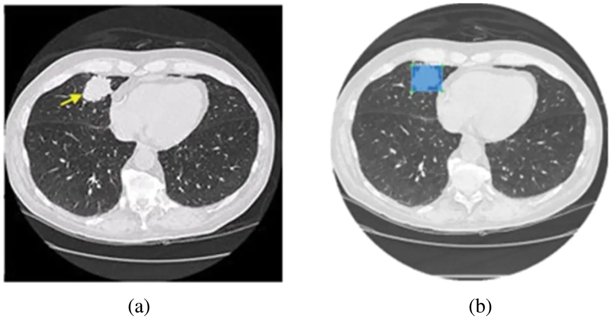 Lung Nodule Detection Based on YOLOv3 Deep Learning with Limited Datasets