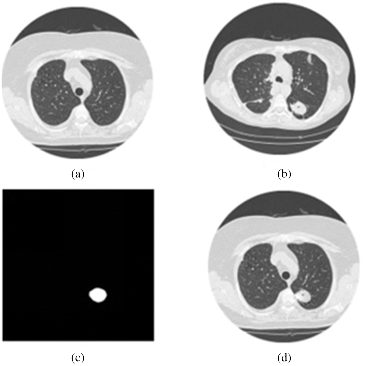Lung Nodule Detection Based on YOLOv3 Deep Learning with Limited Datasets
