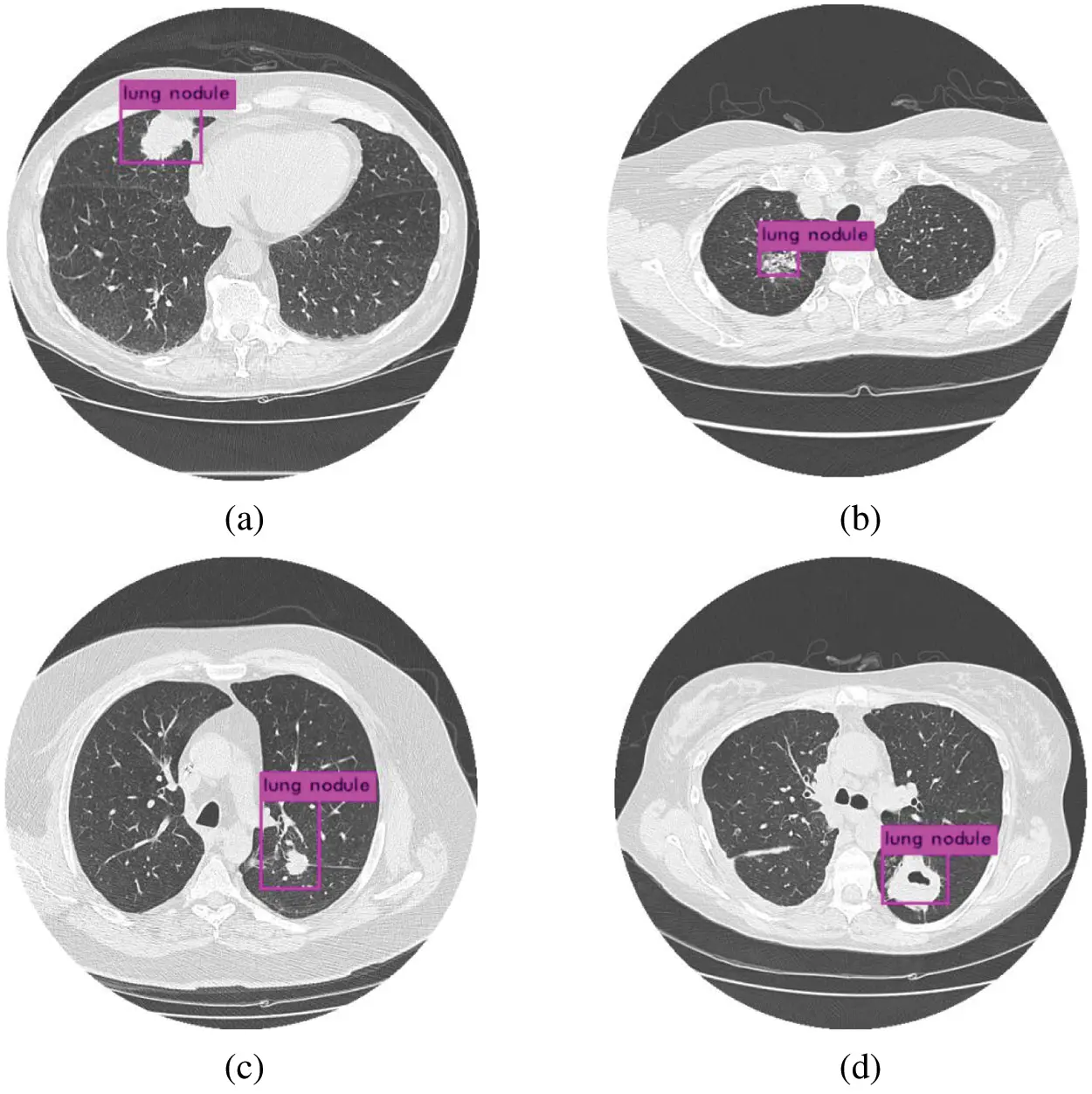 Lung Nodule Detection Based on YOLOv3 Deep Learning with Limited Datasets
