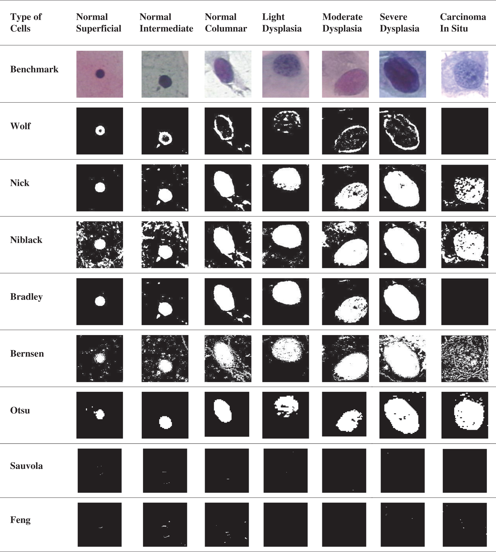 Nucleus Detection on Pap Smear Images for Cervical Cancer Diagnosis: A ...
