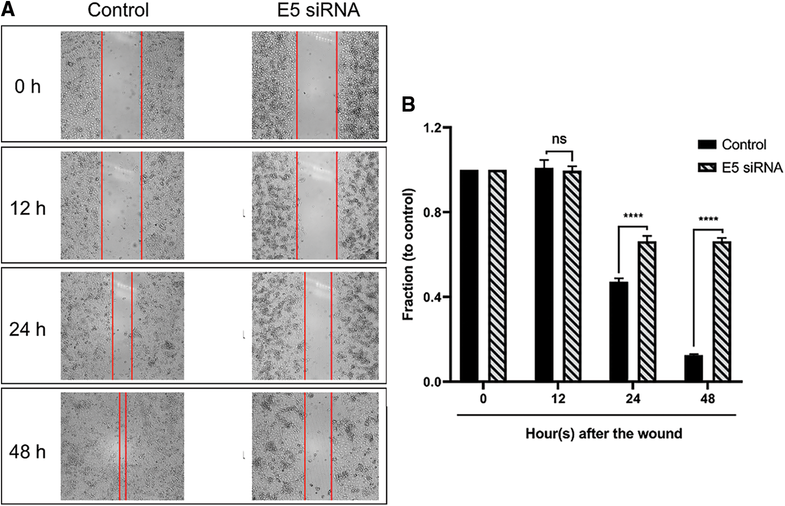 OR | Free Full-Text | Suppression of human papillomavirus type 16 E5 ...