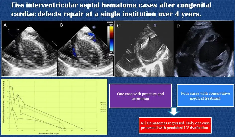 Interventricular Septal Hematoma after Congenital Cardiac Defects Repair at a Single Institution