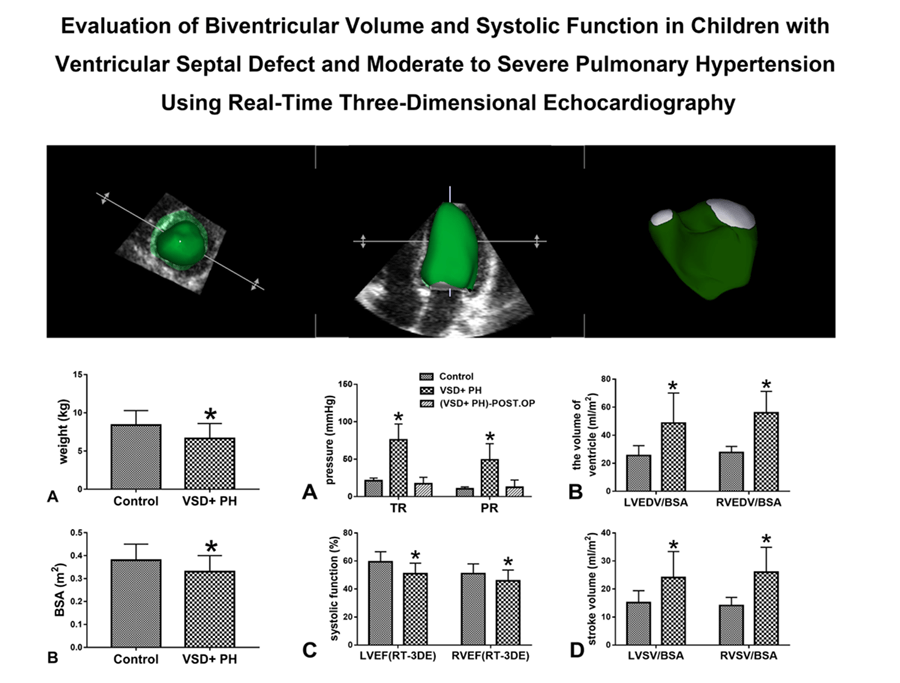 Evaluation of Biventricular Volume and Systolic Function in Children with Ventricular Septal Defect and Moderate to Severe Pulmonary Hypertension Using Real-Time Three-Dimensional Echocardiography