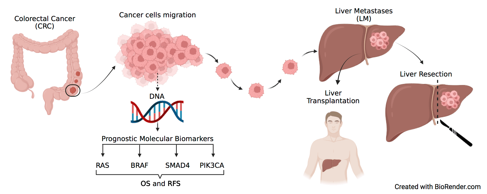 The challenge of molecular selection in liver-limited metastatic colorectal cancer for surgical resection: a systematic review and meta-analysis in the context of current and future approaches