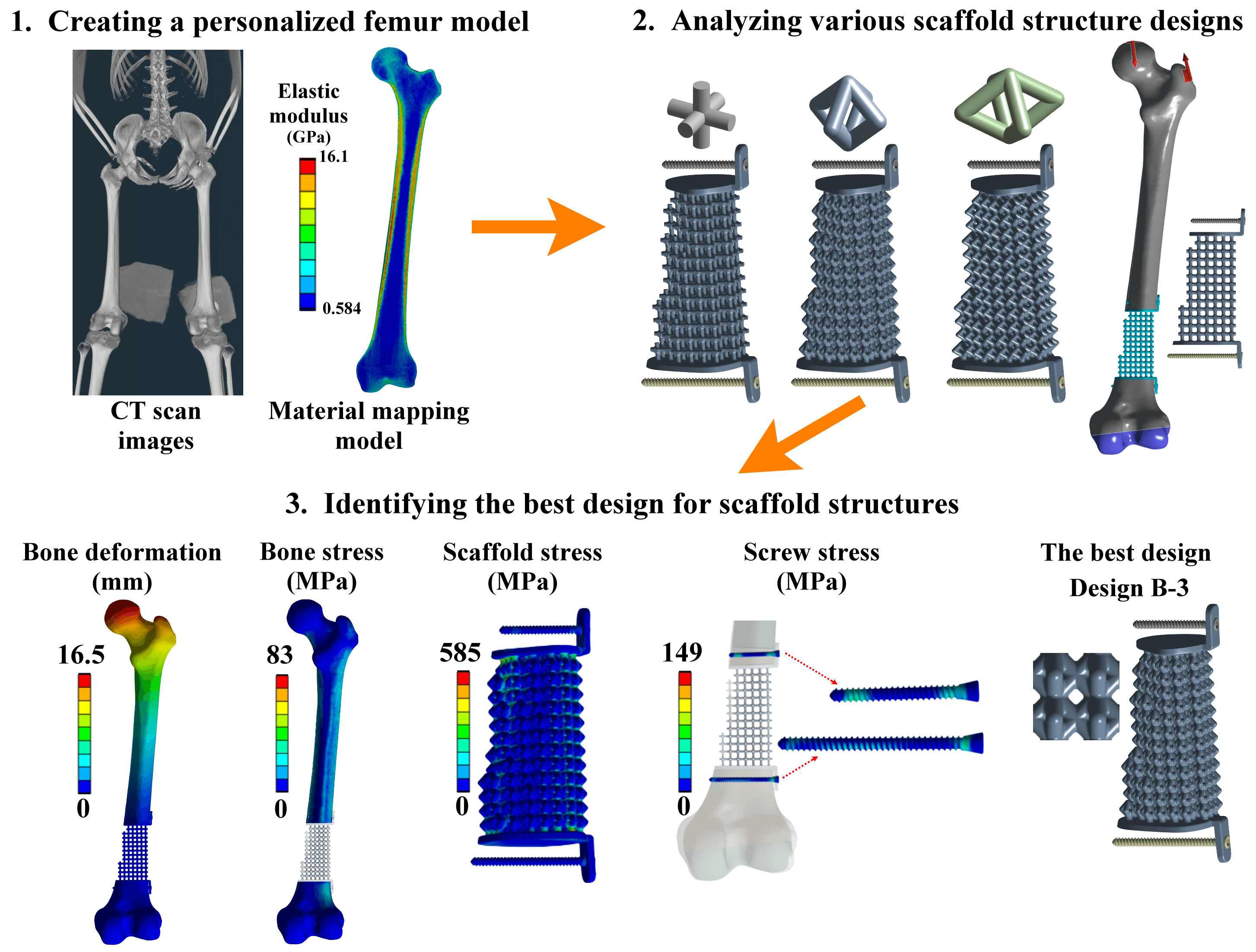 Biomechanical Study of Different Scaffold Designs for Reconstructing a Traumatic Distal Femur Defect Using Patient-Specific Computational Modeling