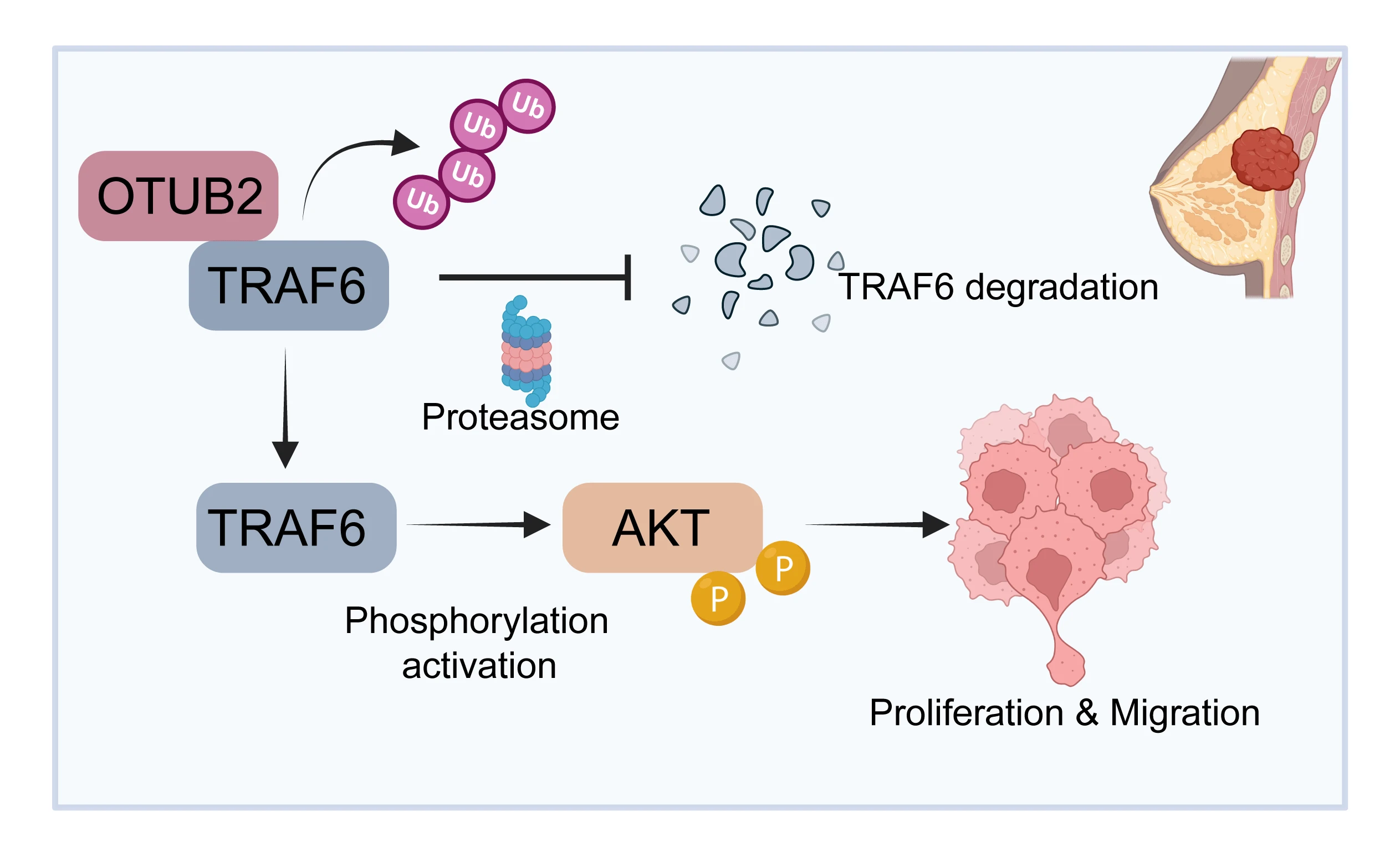 OTUB2 promotes proliferation and metastasis of triple-negative breast cancer by deubiquitinating TRAF6