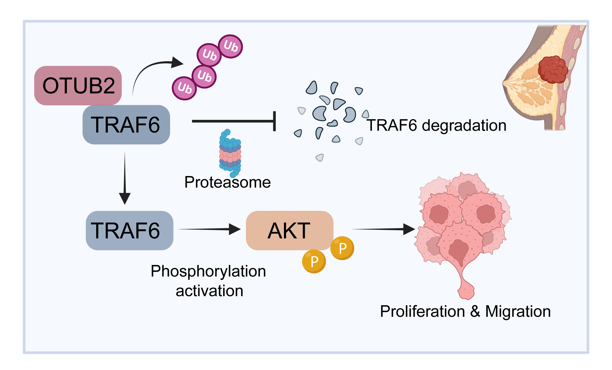 OTUB2 promotes proliferation and metastasis of triple-negative breast cancer by deubiquitinating TRAF6