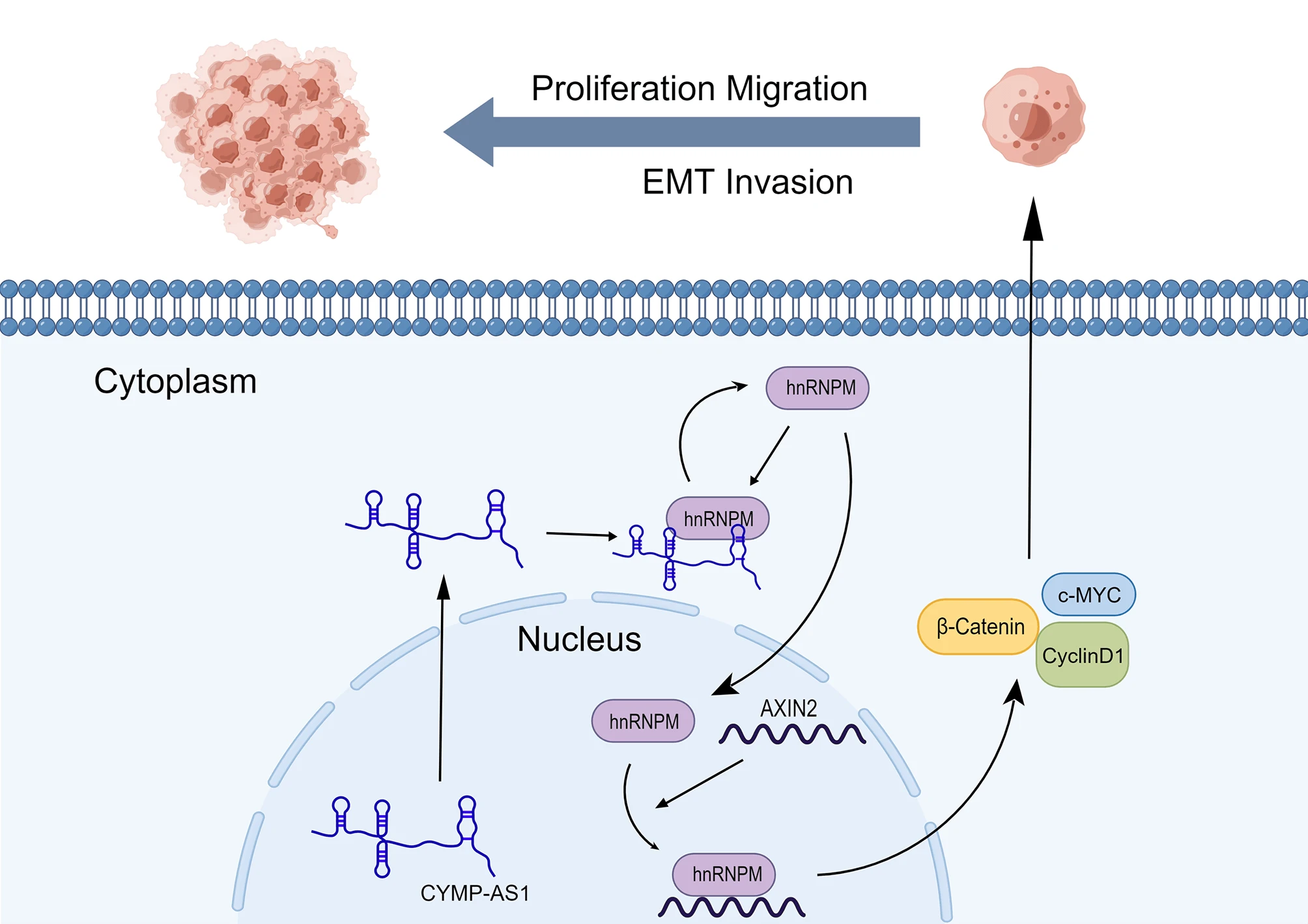 CYMP-AS1 Promotes Ovarian Cancer Progression by Enhancing the Intracellular Translocation of hnRNPM and Reducing the Stability of AXIN2 mRNA