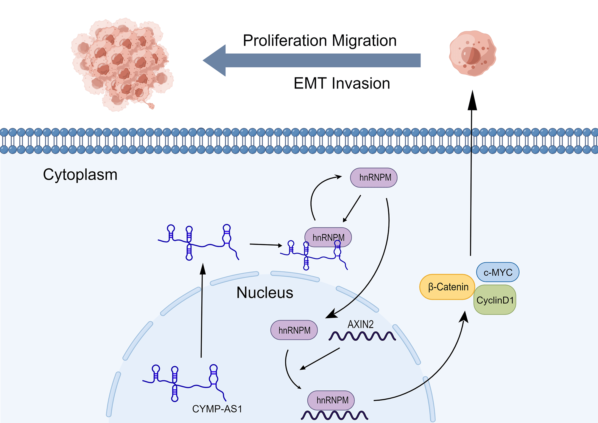 CYMP-AS1 Promotes Ovarian Cancer Progression by Enhancing the Intracellular Translocation of hnRNPM and Reducing the Stability of AXIN2 mRNA