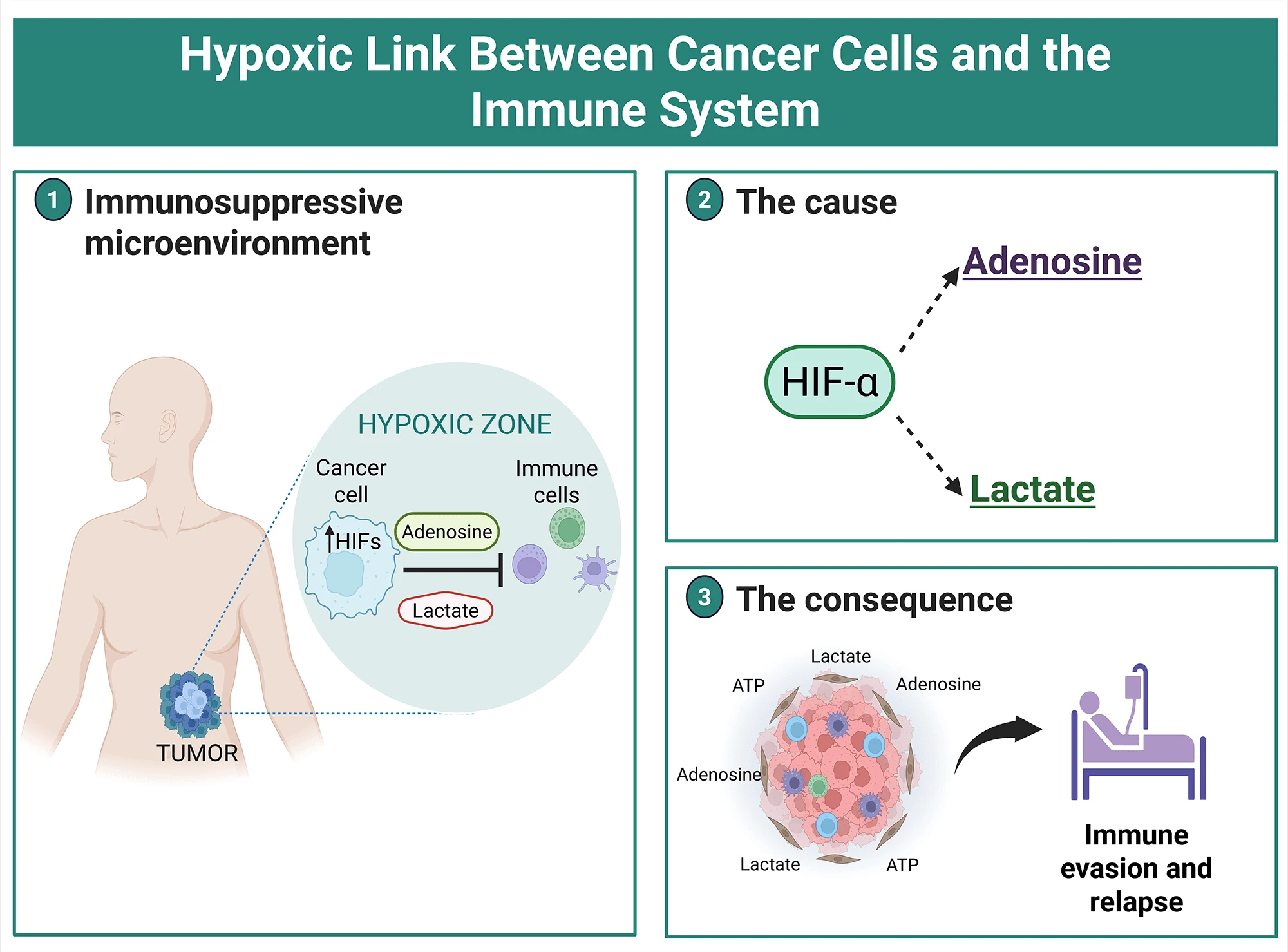 Hypoxic link between cancer cells and the immune system: The role of adenosine and lactate