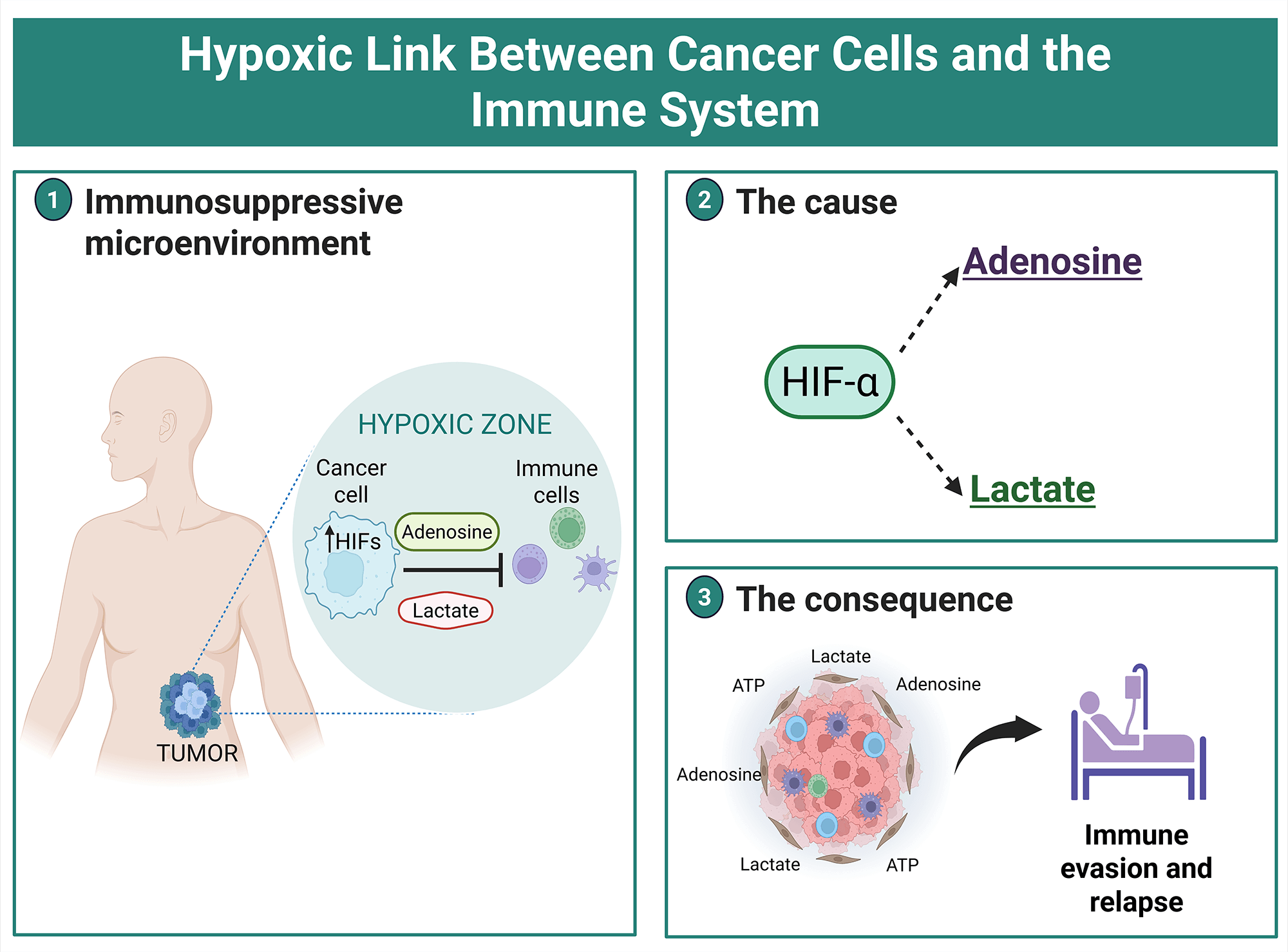 Hypoxic link between cancer cells and the immune system: The role of adenosine and lactate