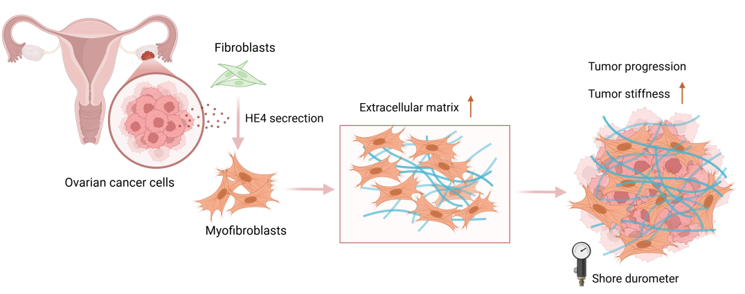 HE4 Might Participate in Extracellular Matrix Remodeling in Ovarian Cancer via Activation of Fibroblasts