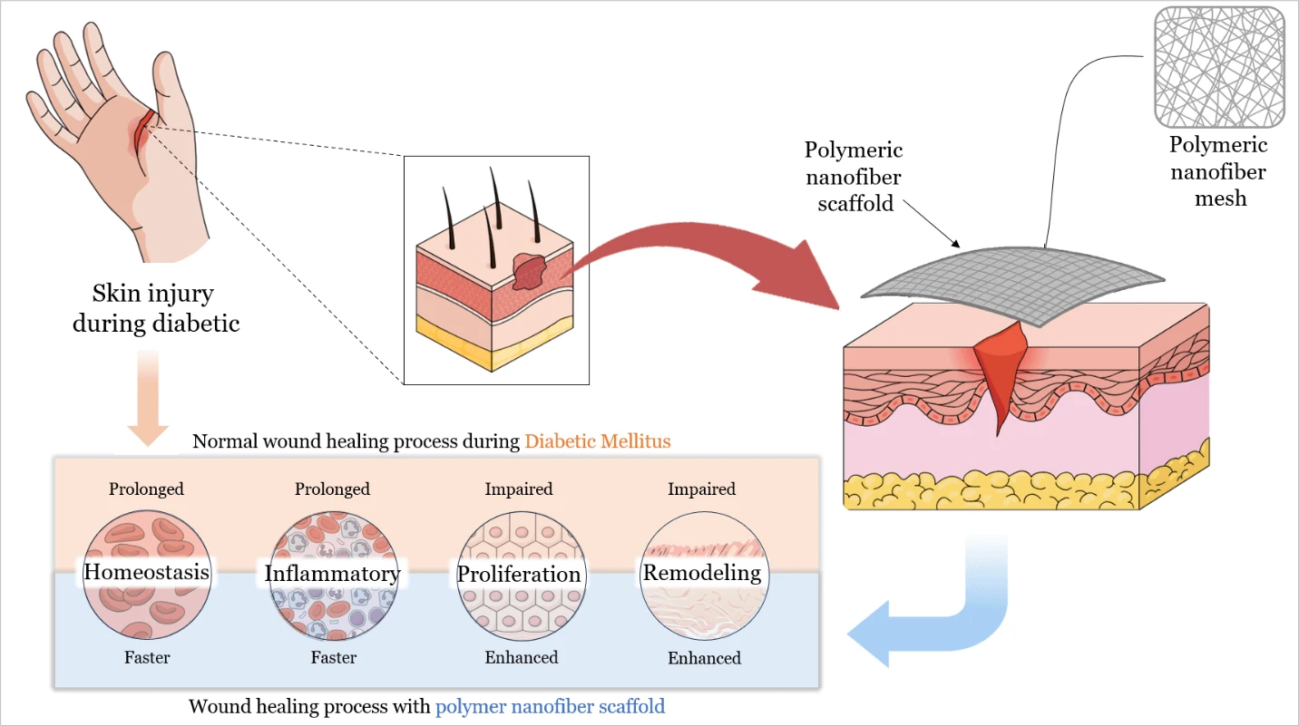 Polymeric Nanofiber Scaffolds for Diabetic Wound Healing: A Review