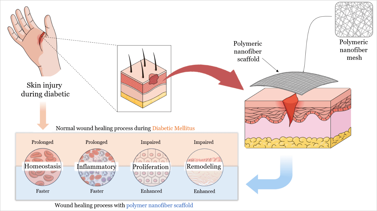 Polymeric Nanofiber Scaffolds for Diabetic Wound Healing: A Review